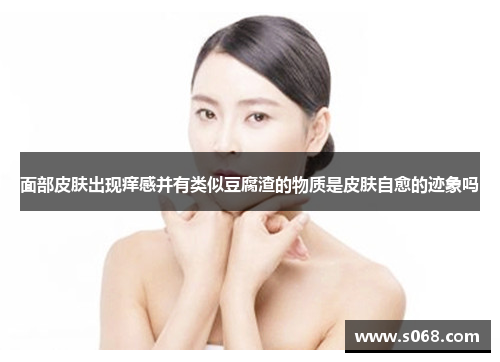 面部皮肤出现痒感并有类似豆腐渣的物质是皮肤自愈的迹象吗